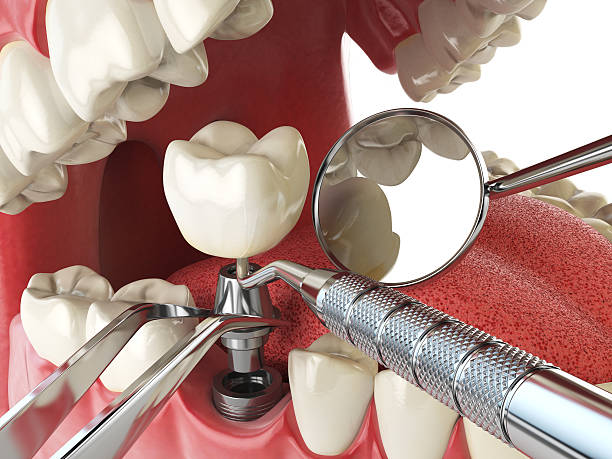 Best Same-Day Emergency Dental Services in Lithia Springs, GA